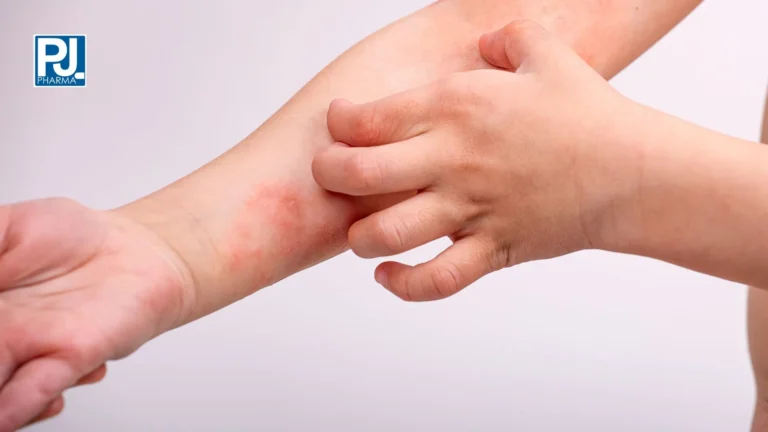 Sollievo per la Dermatite Atopica: l’Azione di Dilcoil