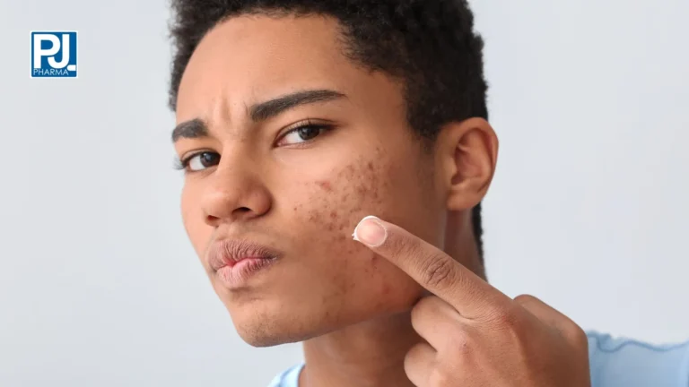 Climbalin: dermal gel for oily and acne-prone skin